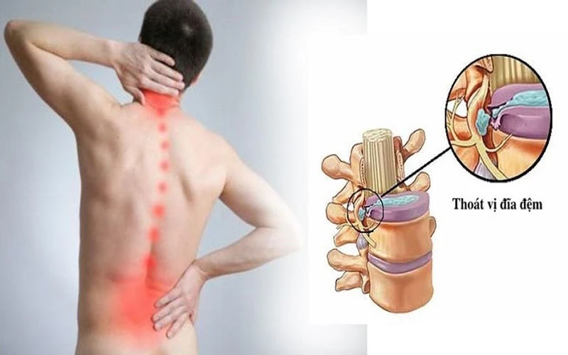 Ghế massage giúp điều trị nhiều chứng bệnh
